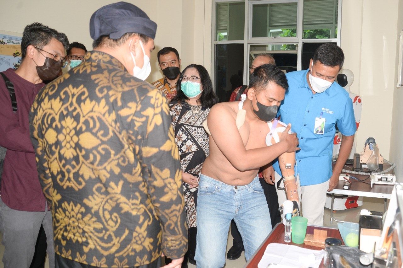 BPJAMSOSTEK Jamin Pemasangan Protese Tangan Robotik Pegawai di Jateng